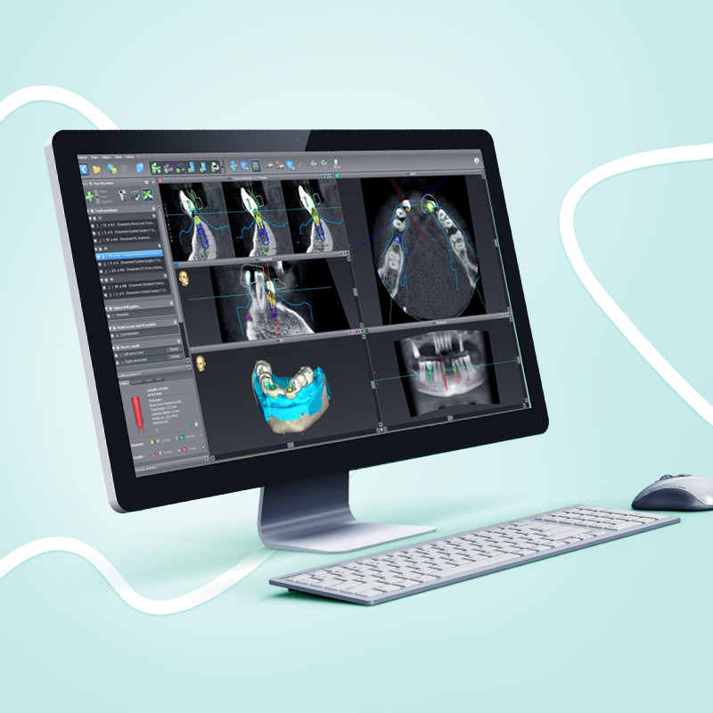 Como funciona a reabilitação oral com implantes e próteses e quais os resultados?