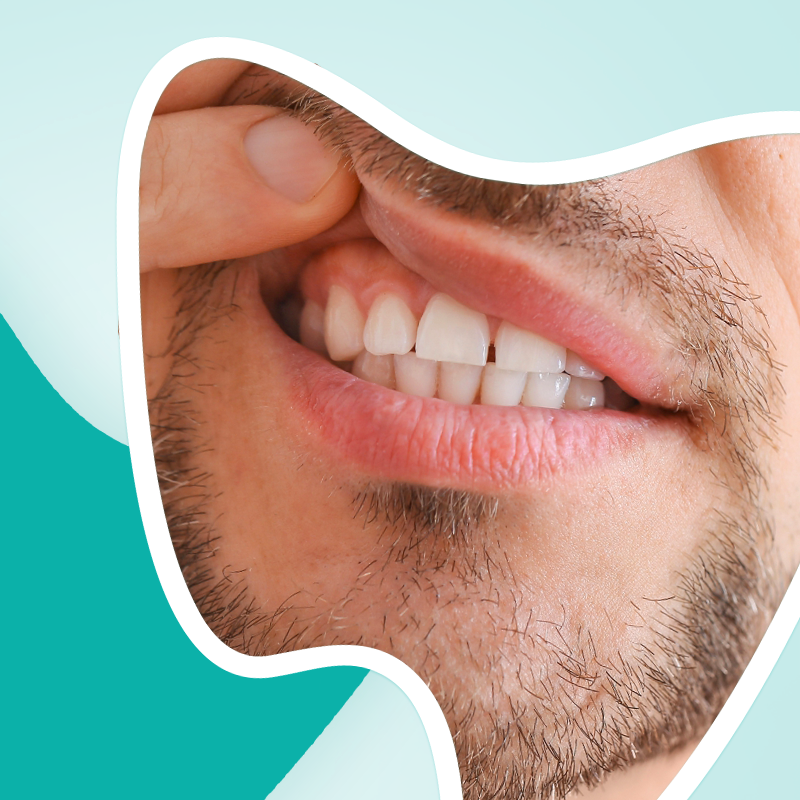 Como cuidar da saúde da gengiva da melhor forma?